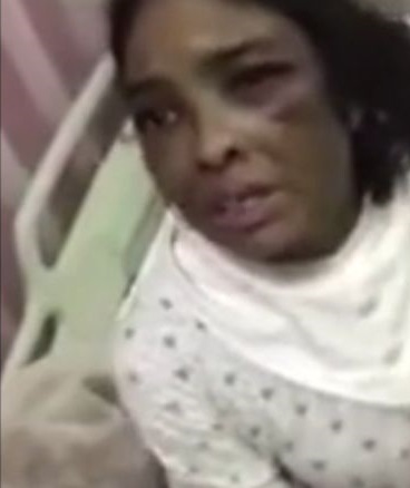 شکنجۀ وحشتناک دختر جوان توسط مرد عرب+عکس
