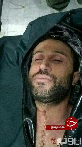 عکس/ چهره مهرداد اولادی در پزشکی قانونی (16+)