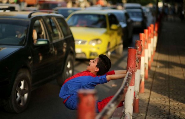 تصاویر : کودک عنکبوتی غزه