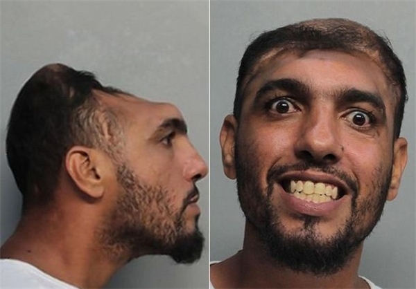 زندگی عجیب مردی با سر نصف شده +عکس