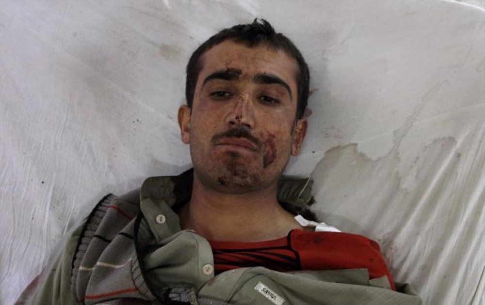 تصاویر : حمله به دانشگاه پلیس در پاکستان