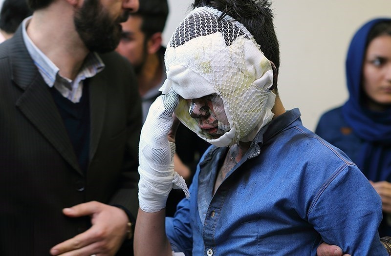 سوختگی ۱۰۰ جوان نوزده ساله بر اثر انفجار مواد محترقه / مجروح حادثه خیابان مرتضوی نبض ندارد