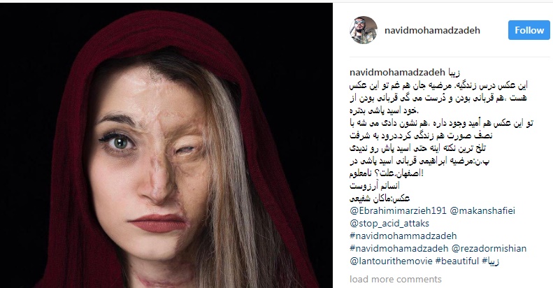 نوید محمدزاده از قربانی اسیدپاشی اصفهان نوشت
