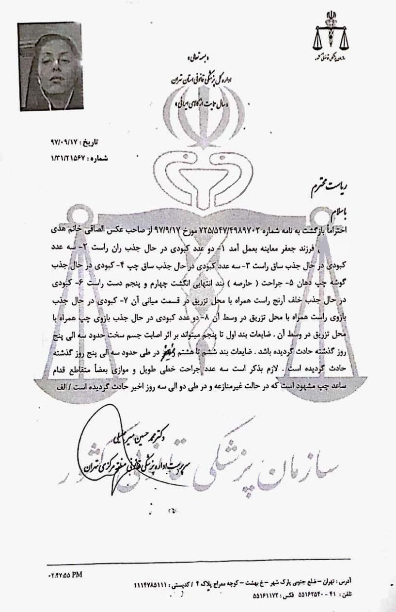 گرجستان ایرانیان را با دست پس زده، با پا پیش میکشد! / از تزریق به ایرانیان در فرودگاه تفلیس تا دیپورت آنها به بهانههای واهی گرجستان ایرانیان را با دست پس زده، با پا پیش میکشد! / از تزریق به ایرانیان در فرودگاه تفلیس تا دیپورت آنها به بهانههای واهی
