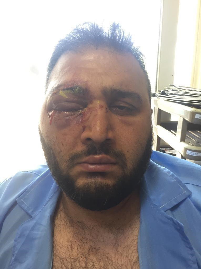 هوادار آسیبدیده پرسپولیس: به فیفا شکایت کنم برخورد شدیدی با سپاهان میکنند/ چه کسی جواب دخترم را میدهد؟+عکس هوادار آسیبدیده پرسپولیس: به فیفا شکایت کنم برخورد شدیدی با سپاهان میکنند/ چه کسی جواب دخترم را میدهد؟+عکس