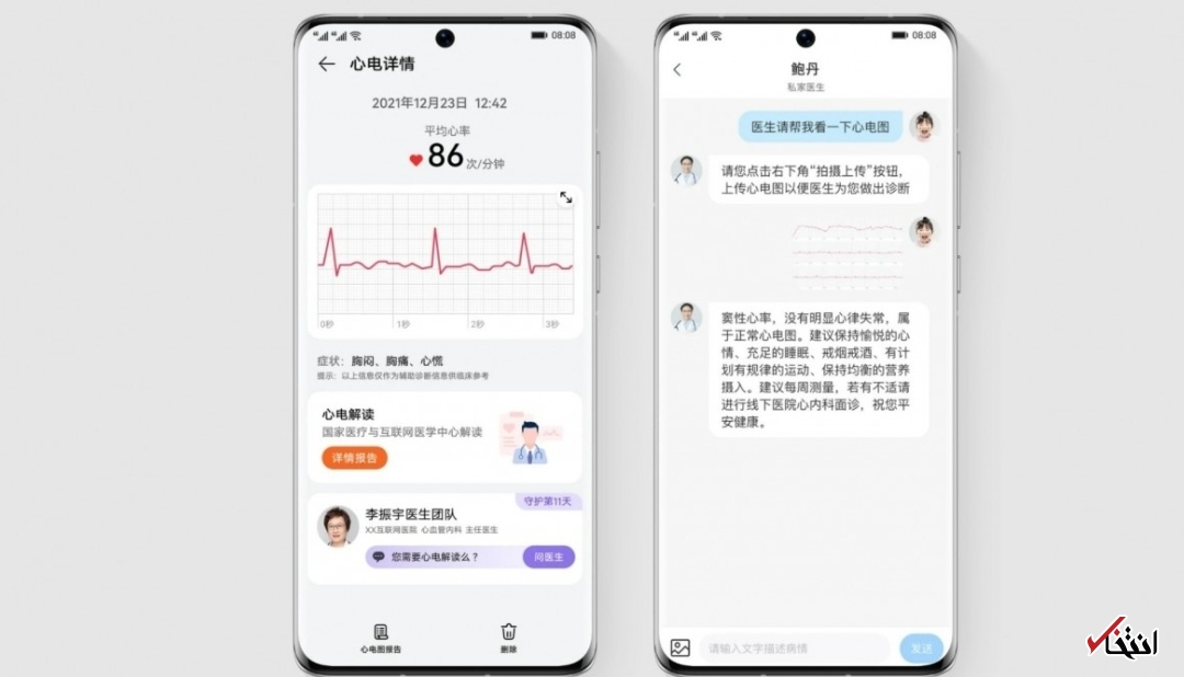 هواوی واچ D با سیستم مانیتورینگ ضربان قلب رونمایی شد