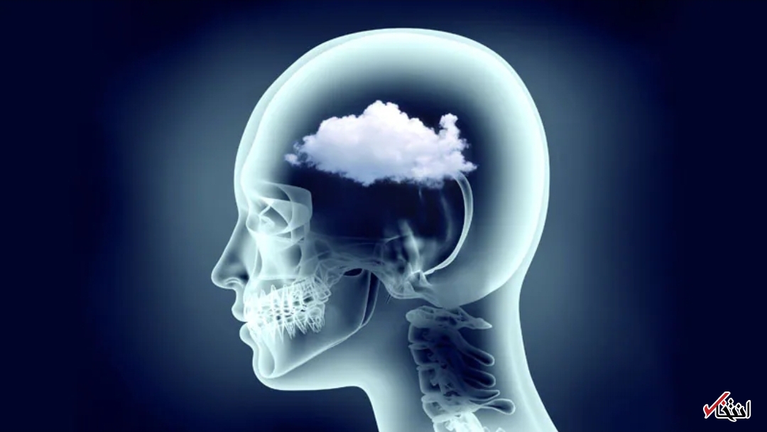 تاثیر خطرناک کرونا بر مغز تاثیر خطرناک کرونا بر مغز