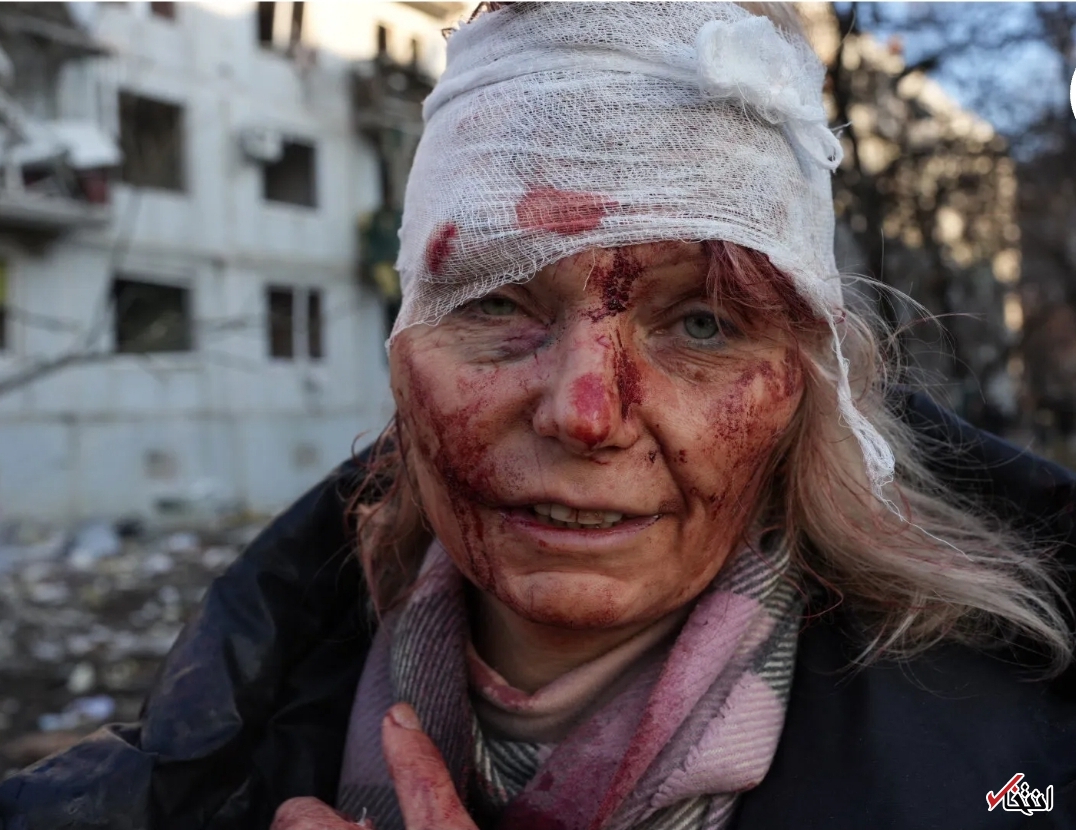 گزارش تصویری از حمله روسیه به اوکراین