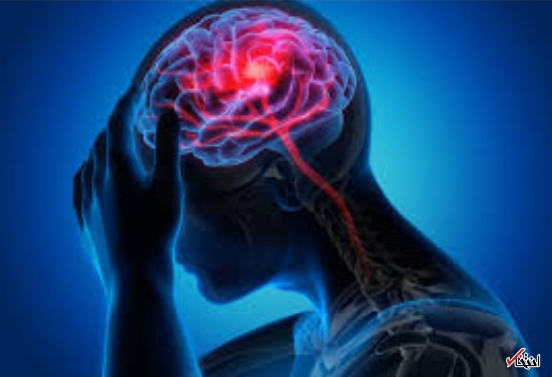 افراد مبتلا به میگرن خواب عمیق کمتری دارند