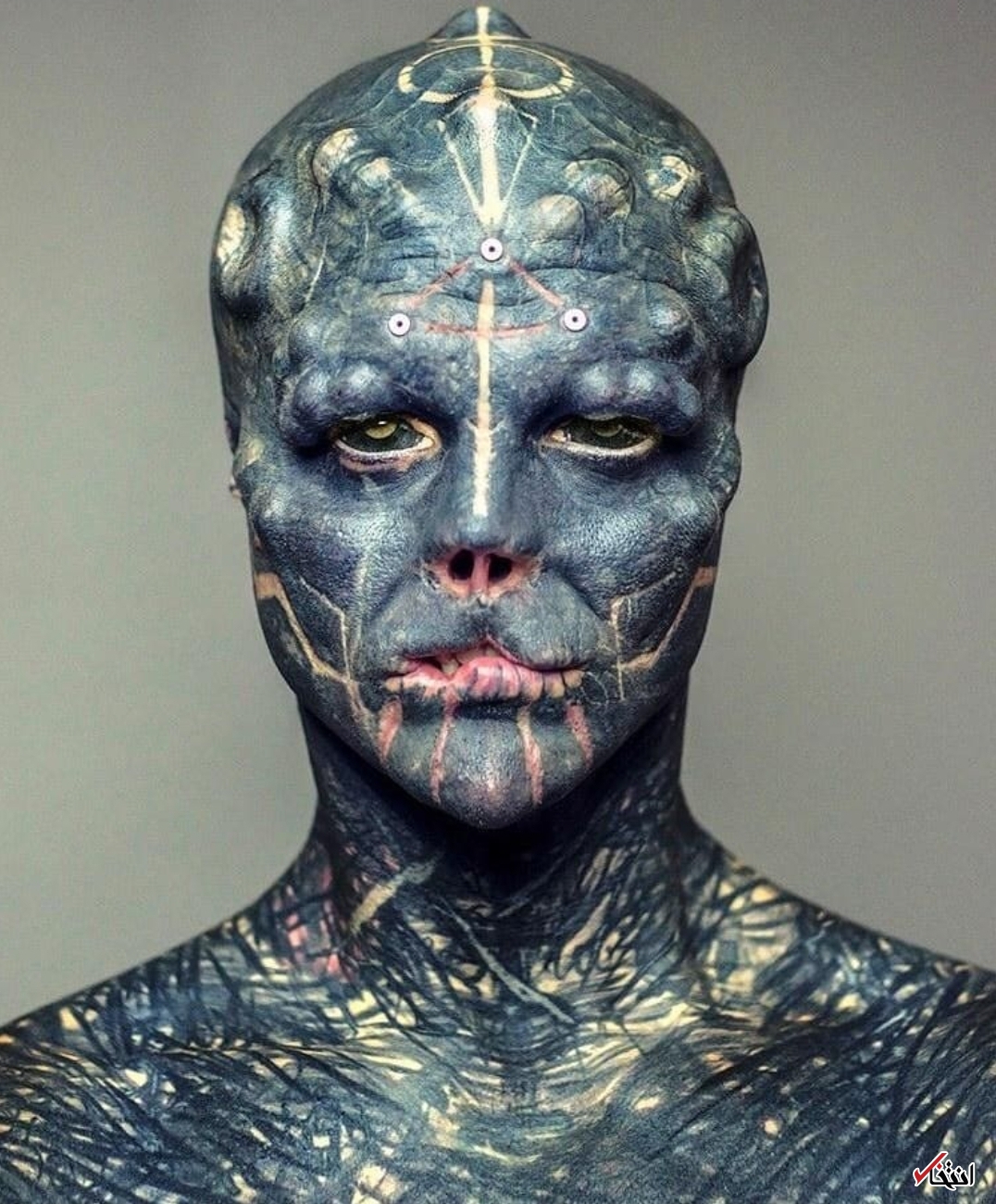 عجیب&zwnj;ترین جراحی زیبایی جهان/قطع انگشتان دست برای ایجاد پنجه! +تصاویر