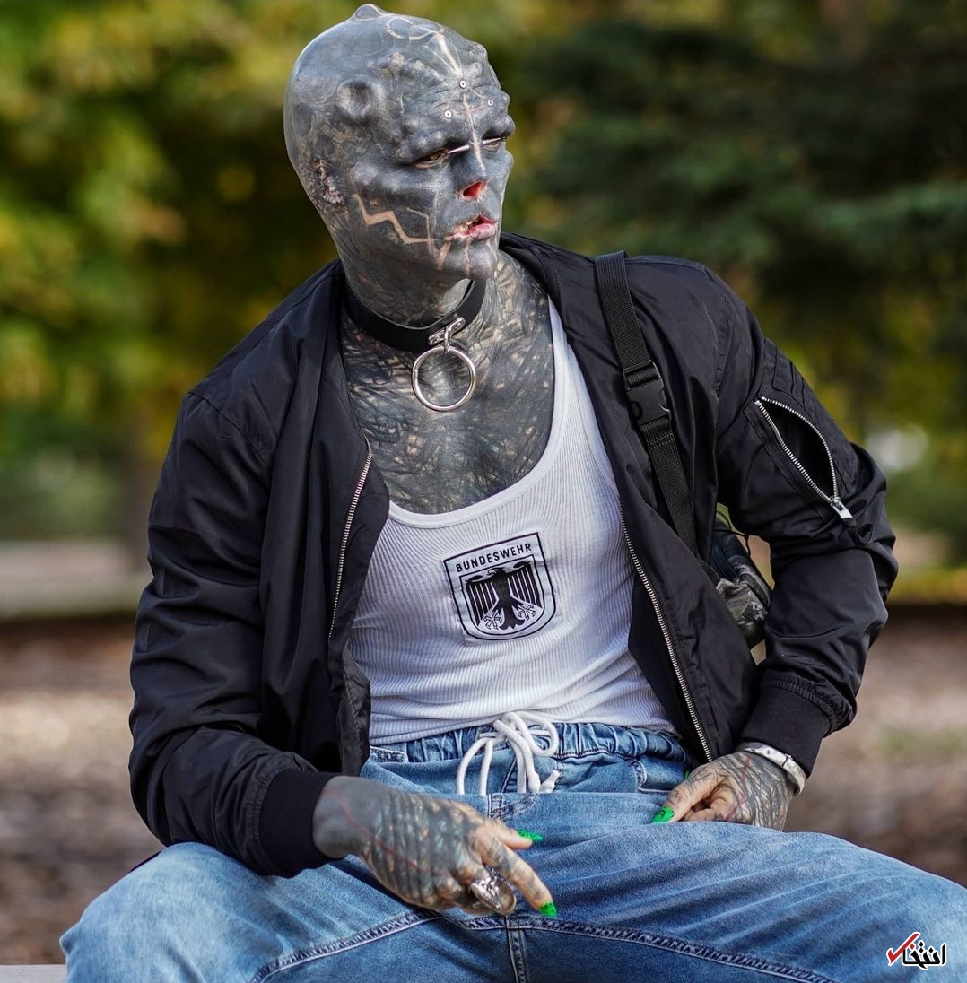 عجیب&zwnj;ترین جراحی زیبایی جهان/قطع انگشتان دست برای ایجاد پنجه! +تصاویر