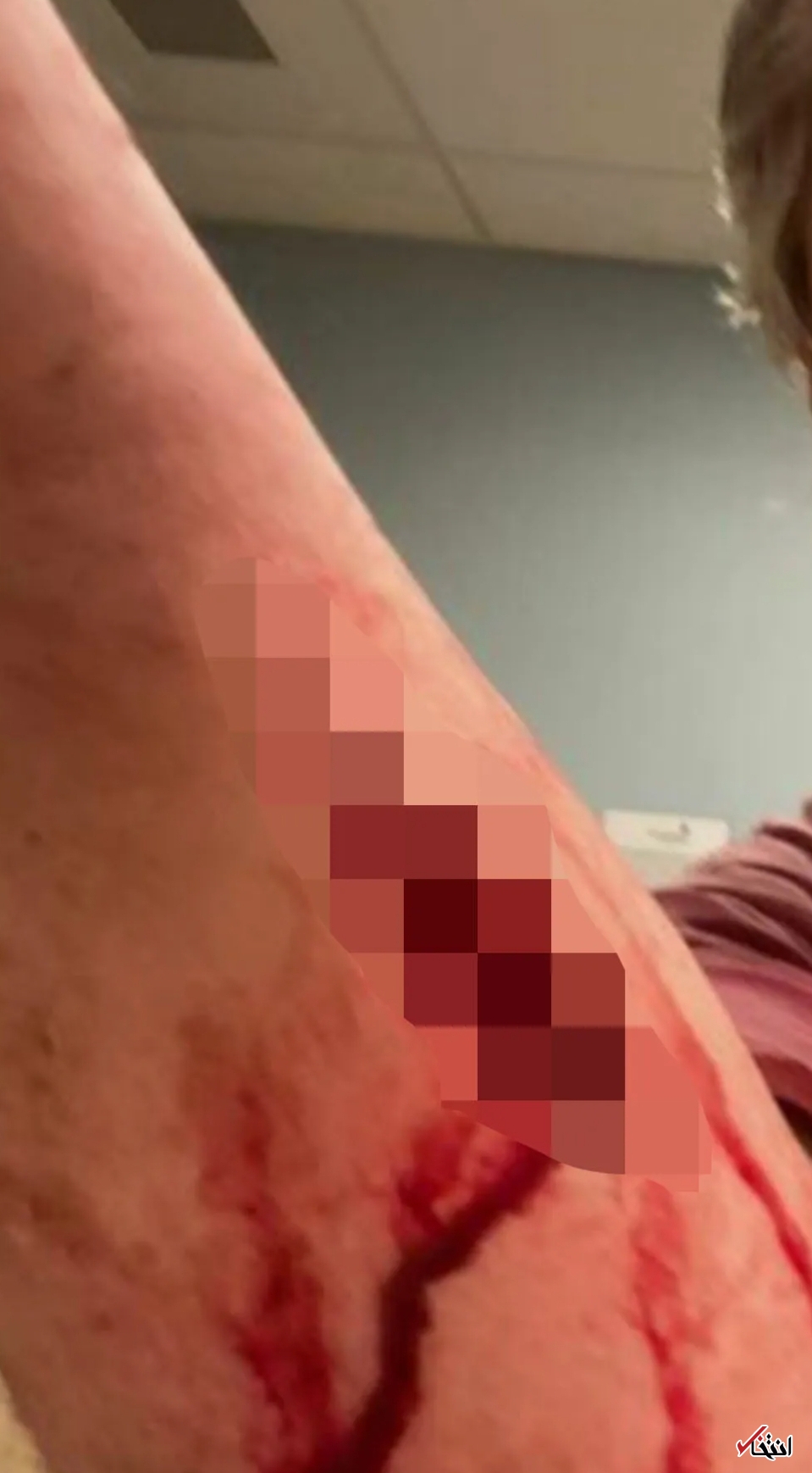 شکایتی عجیب علیه اپل واچ