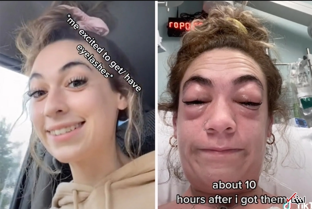 عاقبت وحشتناک اکستنشن مژه+تصاویر