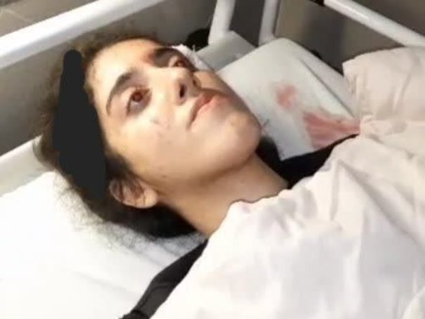 پلیس با تکذیب کشته شدن دختر ۲۰ ساله در پیاده راه فرهنگی رشت: او از ناحیه سر دچار آسیب شده / پس از معاینات پزشکی و تهیه عکس رادیولوژی مشخص شد موضوع صدمه وارده به او چندان جدی نبوده پلیس با تکذیب کشته شدن دختر ۲۰ ساله در پیاده راه فرهنگی رشت: او از ناحیه سر دچار آسیب شده / پس از معاینات پزشکی و تهیه عکس رادیولوژی مشخص شد موضوع صدمه وارده به او چندان جدی نبوده