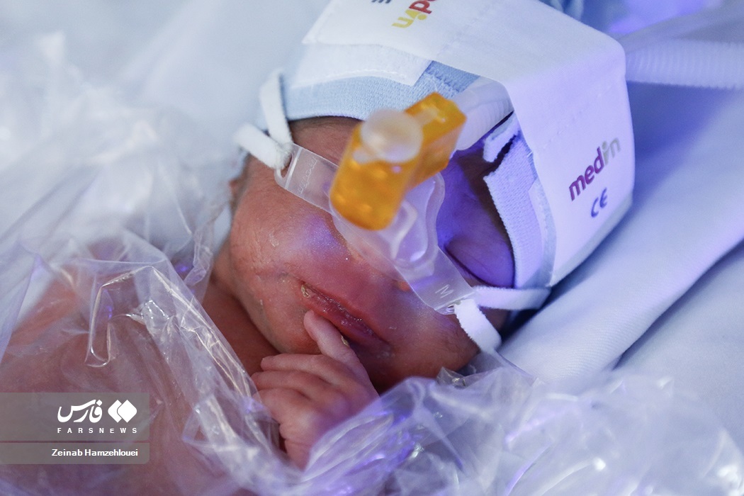 تصاویر: تولد پنج قلوها