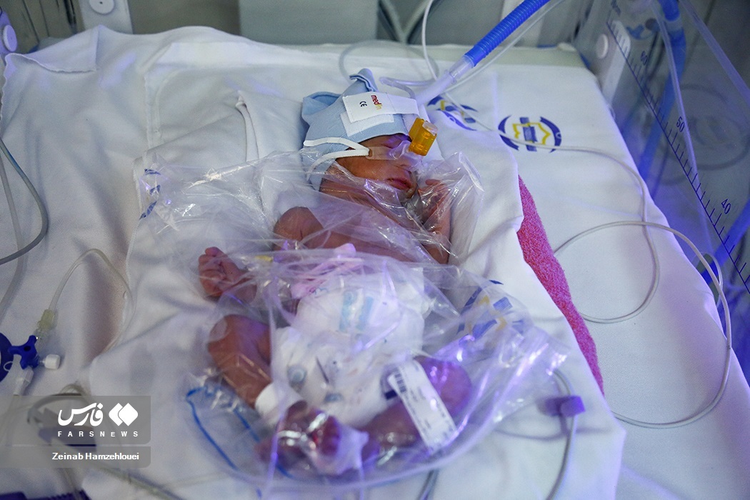 تصاویر: تولد پنج قلوها