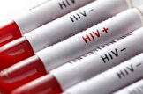 آخرین وضعیت HIV در کشور؛ تغییر الگوی راه انتقال و درصد ابتلای زنان و مردان / در شش ماهه اول امسال ۲۸ درصد موارد ثبت شده بیماری را زنان و ۷۲ درصد آن‌ها را مردان تشکیل می‌دهند