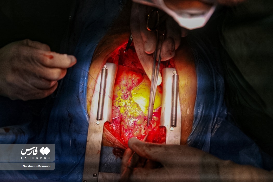 تصاویر: عمل قلب باز در البرز