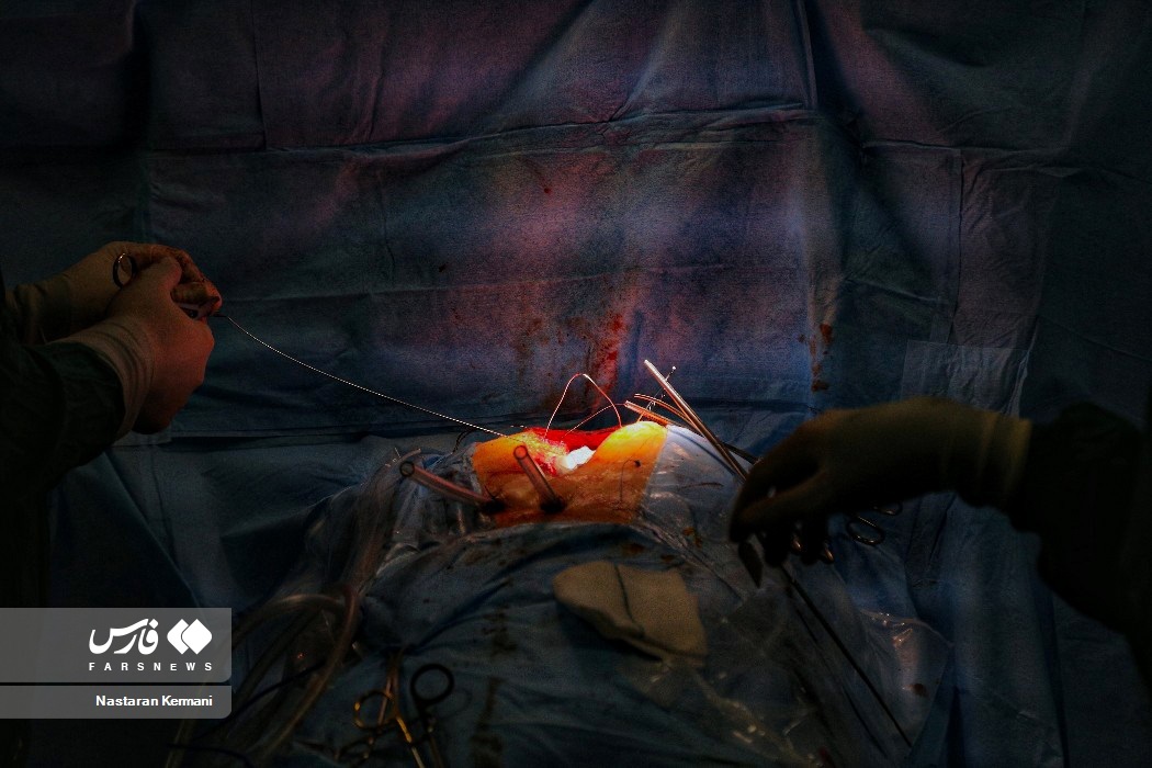 تصاویر: عمل قلب باز در البرز