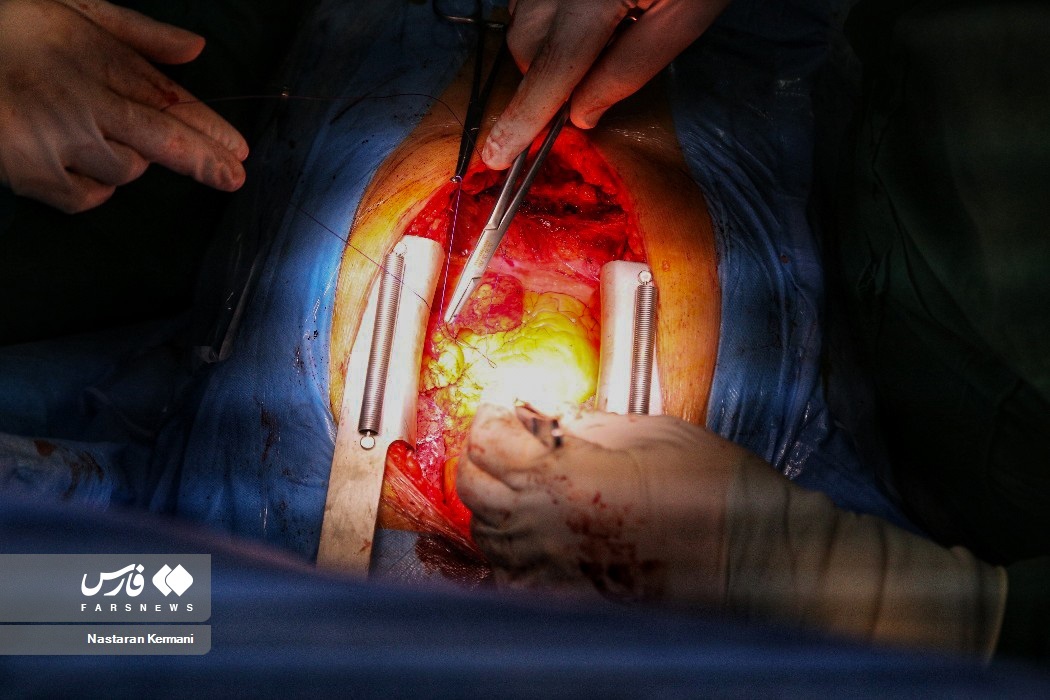 تصاویر: عمل قلب باز در البرز