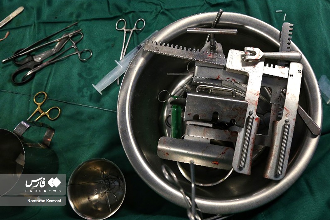 تصاویر: عمل قلب باز در البرز