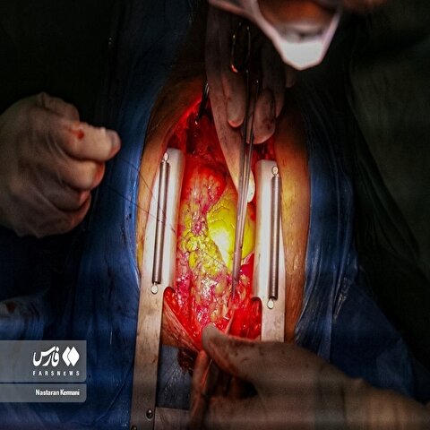 تصاویر: عمل قلب باز در البرز