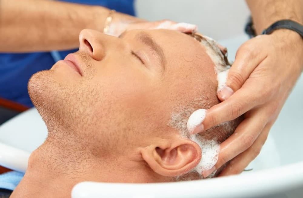 مراقبت های بعد از کاشت مو مراقبت های بعد از کاشت مو