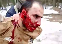 ببینید / بازداشت سومین عامل حمله تروریستی در مسکو با چهره ای خون آلود