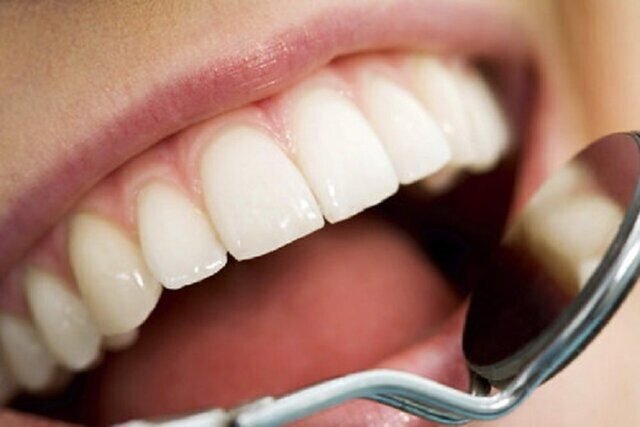 سلامت دهان و دندان ضامن تقویت سلامتی قسمت‌های مختلف بدن