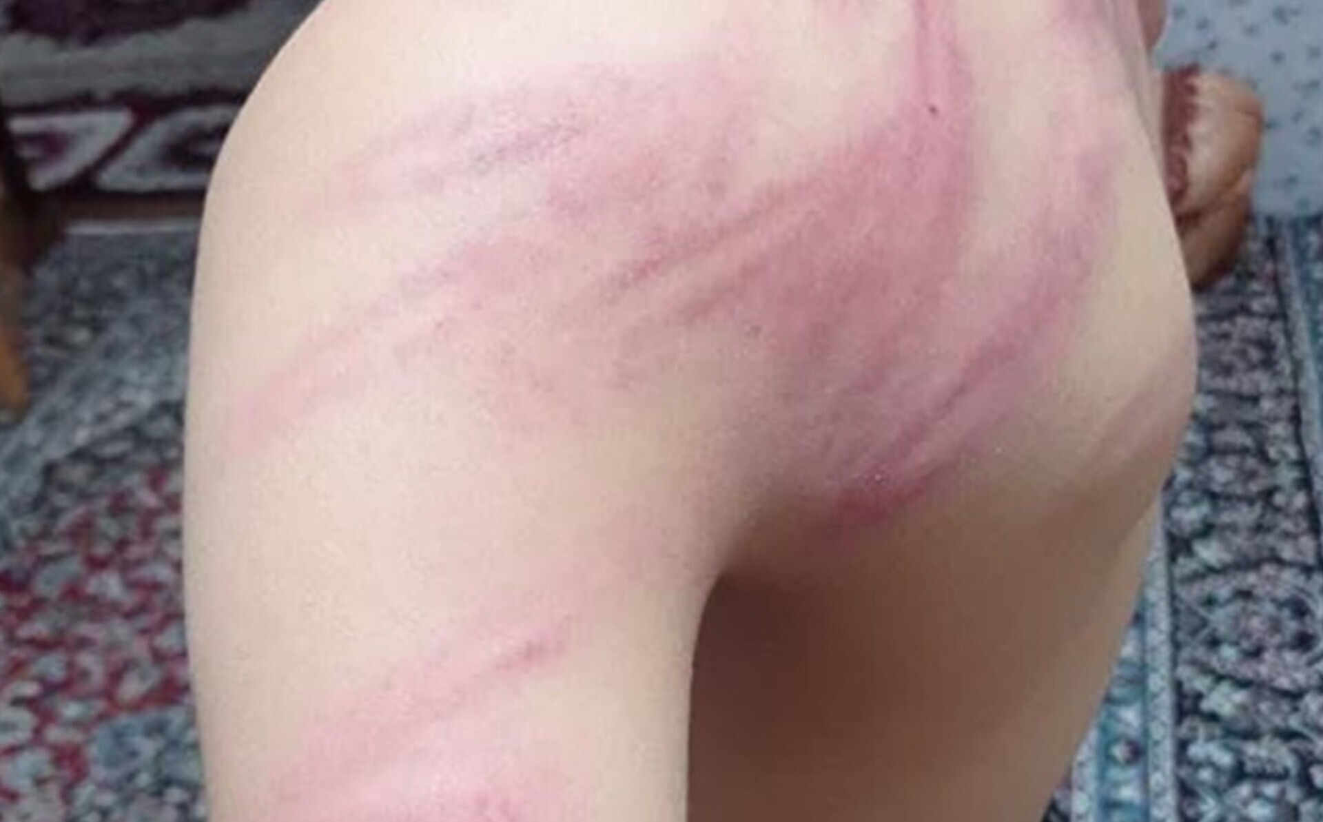 ضرب‌وشتم وحشتناک دانش‌آموزان توسط معلم به علت گم شدن شارژر موبایل/ یک دانش‌آموز در بیمارستان بستری شد/ آموزش وپرورش ناحیه ۲ سنندج: معلم خاطی مشکل روانی دارد/ حکم اخراجش از شهرستان صادر می‌شود