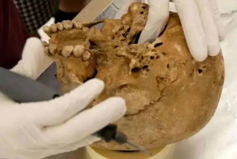 این اسکلت ۱۲ هزار ساله یک بیماری ژنتیکی نادر دارد!