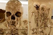 این اسکلت ۱۲ هزار ساله یک بیماری ژنتیکی نادر دارد!