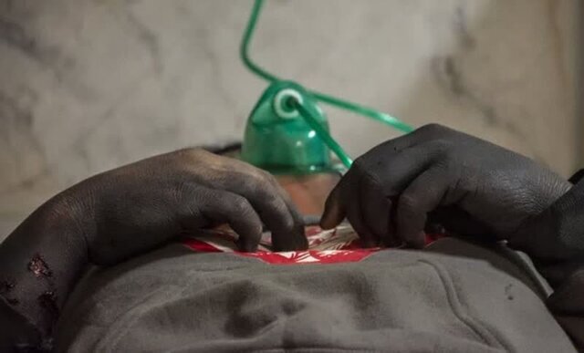 اورژانس: ۲ کشته و ۹۴۵ مصدوم در چهارشنبه سوری/ کاهش ۷۰ درصدی مجروحان و ۹۰ درصدی کشته‌شدگان/ ۴۰ قطع عضو، ۲۴۰ آسیب چشمی و ۲۰۰ سوختگی به ثبت رسید