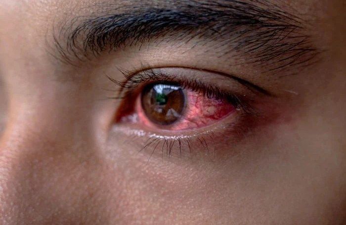 انفجار چه آسیب‌هایی می‌تواند به چشم بزند و چه کار باید کرد؟