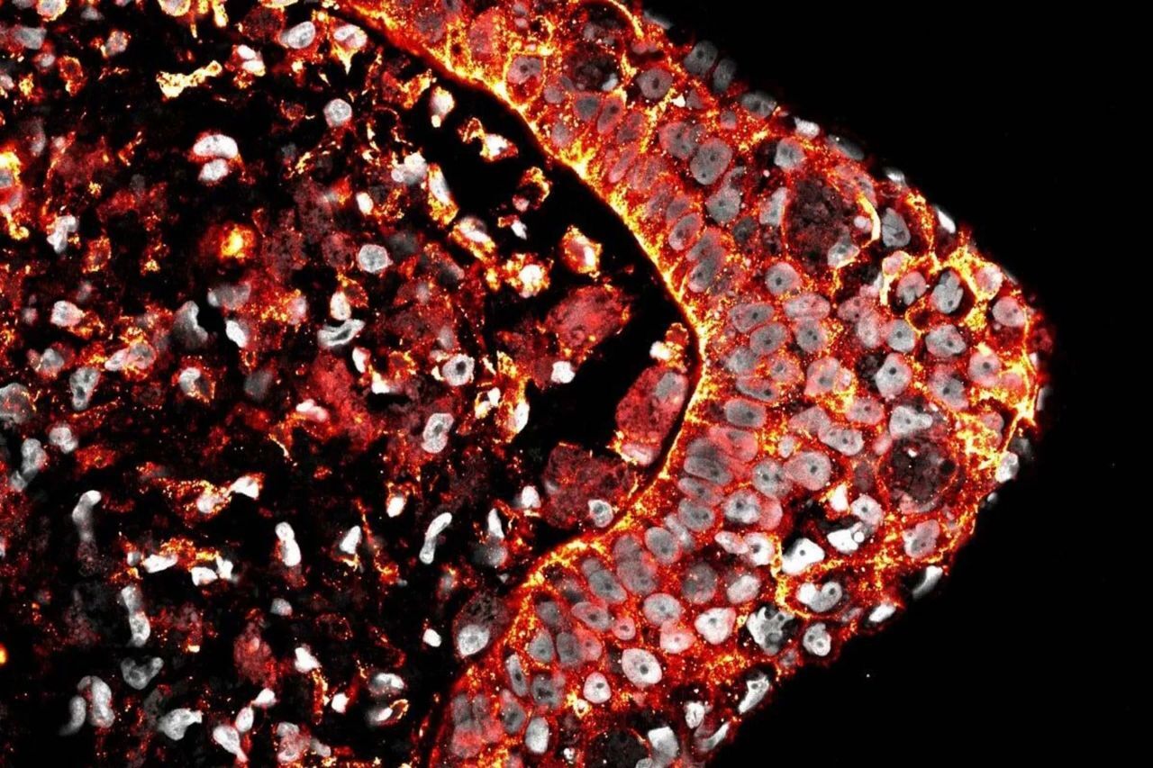 چرا انسان توانایی بازسازی اندام‌های خود را ندارد؟ پژوهشی تازه پاسخ می‌دهد