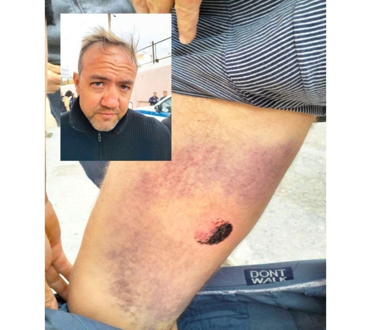جزئیات هولناک از شکنجه ۴۰ ساعته فعالان کاروان صمود + تصاویر