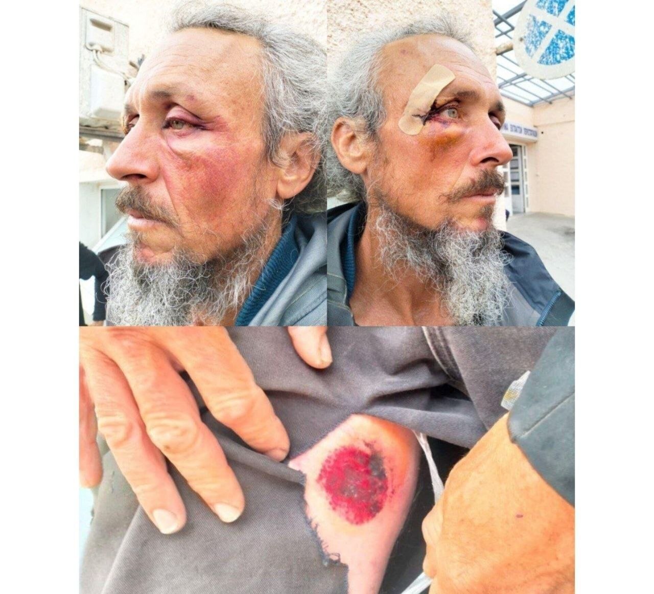 جزئیات هولناک از شکنجه ۴۰ ساعته فعالان کاروان صمود + تصاویر