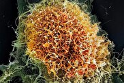 از هانتاویروس تا ابولا: چرا شیوع اخیر ویروس‌ها دانشمندان را سردرگم کرده است؟