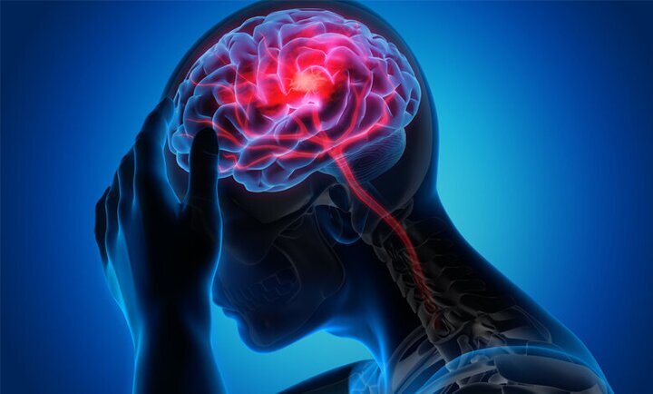 آیا مادر بودن از سکته مغزی پیشگیری می‌کند