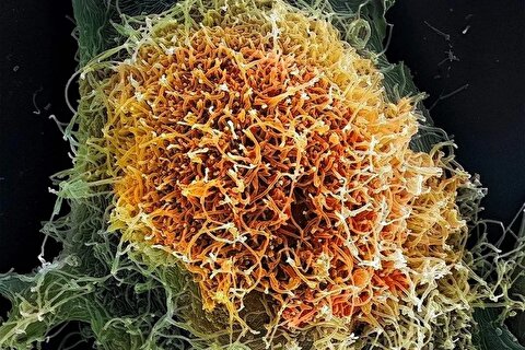 از هانتاویروس تا ابولا: چرا شیوع اخیر ویروس‌ها دانشمندان را سردرگم کرده است؟
