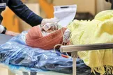 وزارت بهداشت: میزان سوختگی در کشور ۸ برابر میانگین جهانی است / هر ساله ۳۰۰۰ نفر در اثر سوختگی در ایران جان خود را از دست می‌دهند