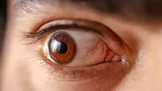 چین یک کلینیک چشم را با هوش مصنوعی اداره کرد؛ نتیجه چه بود؟