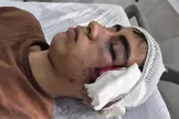مصدومیت شدید دانش‌آموز دهبکری بم توسط معلم /  پدر این دانش‌آموز: معلم کلاس با دسته صندلی به سر و صورت فرزندم کوبیده / سال گذشته نیز همین معلم با پرخاشگری لفظی، گلوی فرزندم را به‌گونه‌ای فشرد که نزدیک بود خفه شود