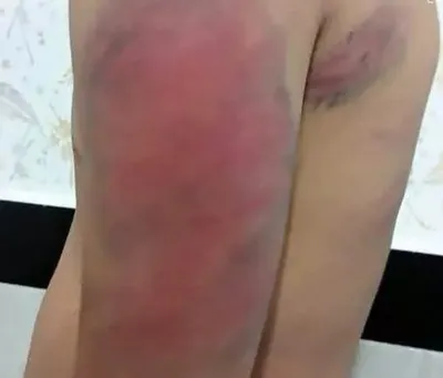 تشکیل پرونده قضائی برای ضرب و جرح دانش‌آموزان کردستانی