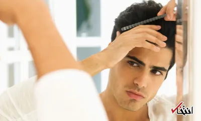 مهم ترین علل کم پشتی و ریزش ناگهانی موها چیست؟