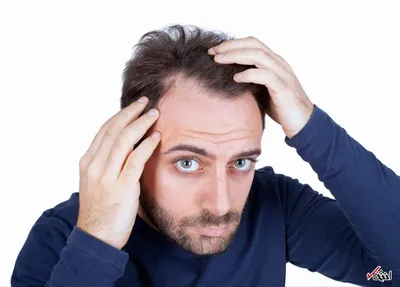 دلایل شگفت آور ریزش موی شما (قسمت اول)