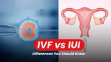 IUI یا IVF؛ تفاوت این دو روش چیست و کدام‌یک برای شما مناسب‌تر است؟